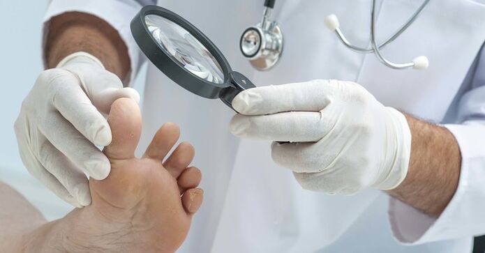Diagnosesch Untersuchung vu Zehennagelen